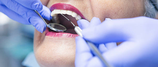 Best Broken or Chipped Tooth Repair in Prospect, OH